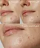 By BEAUTY BAY - Hydrocolloid Spot Patches x 2 Duo - 288pcs