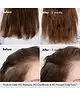 BondiBoost - Procapil Hair Tonic