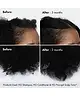 BondiBoost - Procapil Hair Tonic