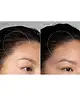 Foreo - LUNA™ 4 Hair