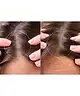 Foreo - FAQ 301 LED Hair Strengthening Scalp Massager