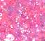 GLIS0114F